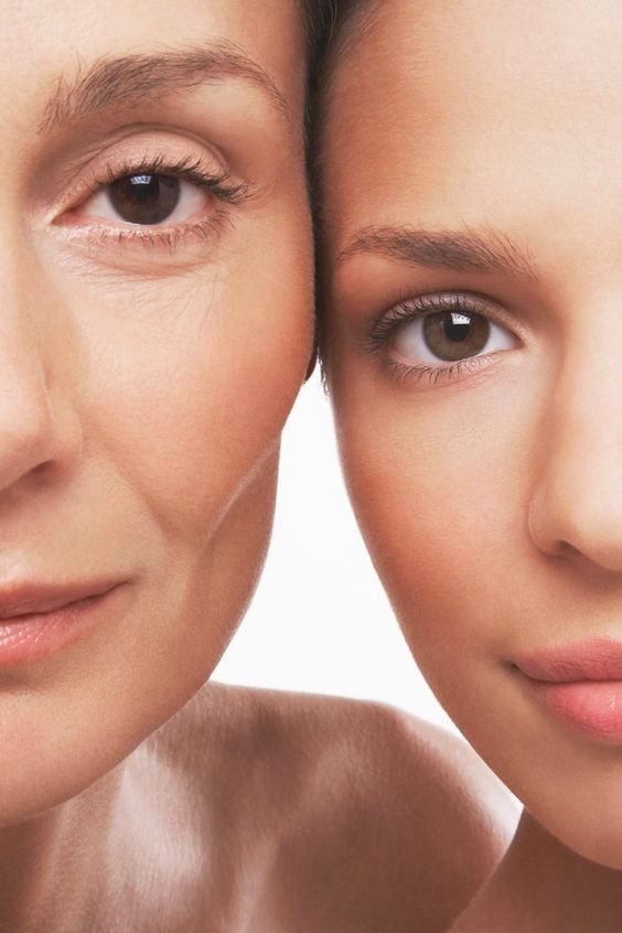 flacidez rejuvenescimento rugas